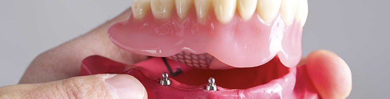 Implant Dentist Flat Rock MI